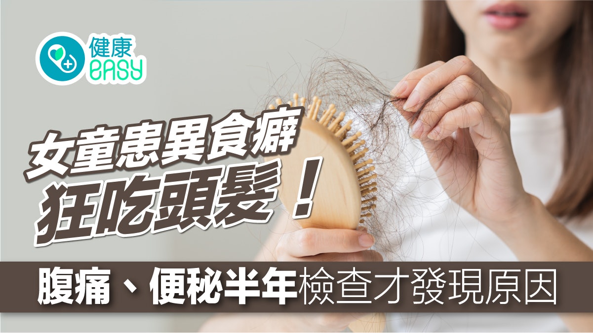 肚痛丨女童患異食癖狂吃頭髮!腹痛、便秘半年檢查才發現原因 肚痛丨女童患異食癖狂吃頭髮!腹痛、便秘半年檢查才發現原因