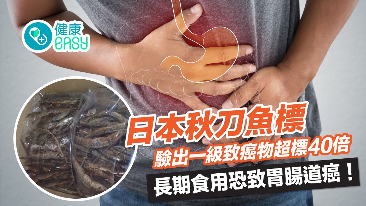 食物安全｜日本秋刀魚標驗出一級致癌物超標40倍 長期食用或致癌