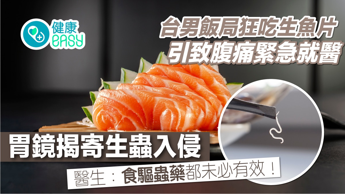 食物安全｜台男愛吃魚生片突腹痛掛急診！胃鏡驚見寄生蟲入侵