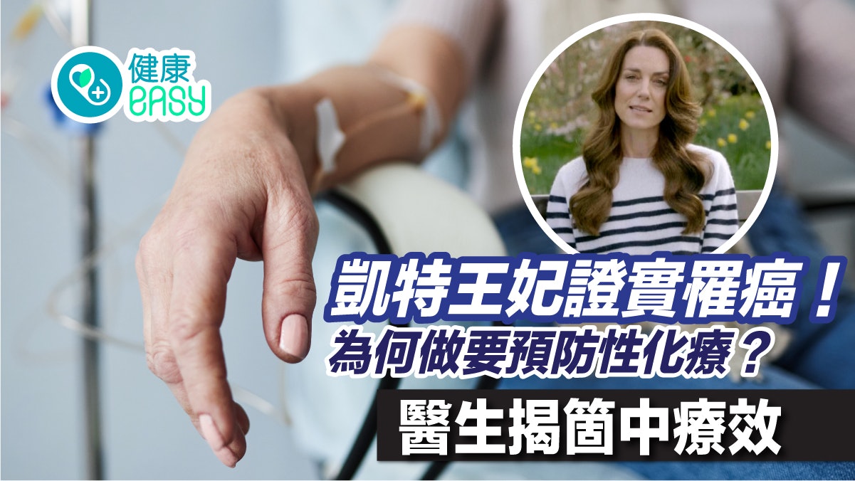 英國王室|凱特王妃證實罹癌!為何做預防性化療?醫揭箇中療效 英國王室|凱特王妃證實罹癌!為何做預防性化療?醫揭箇中療效