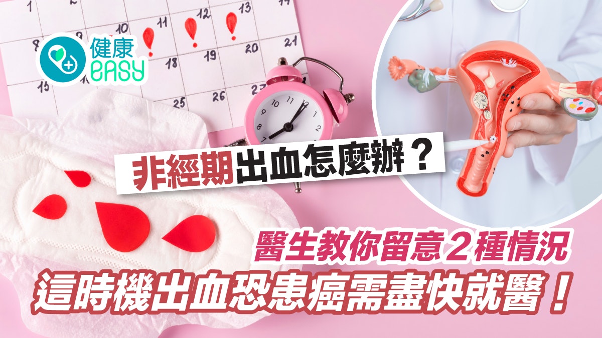 婦女健康|非經期出血怎麼辦?醫揭1情況恐患癌這時機出血需就醫 婦女健康|非經期出血怎麼辦?醫揭1情況恐患癌這時機出血需就醫