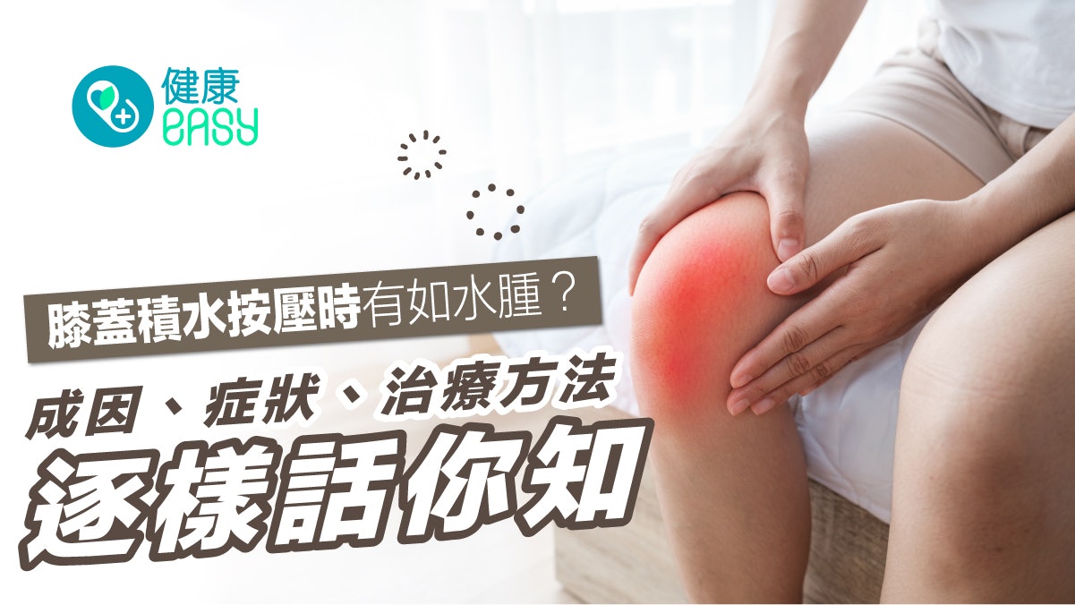 膝痛|膝蓋積水按壓時有如水腫?一文看清成因、症狀、治療方法 膝痛|膝蓋積水按壓時有如水腫?一文看清成因、症狀、治療方法