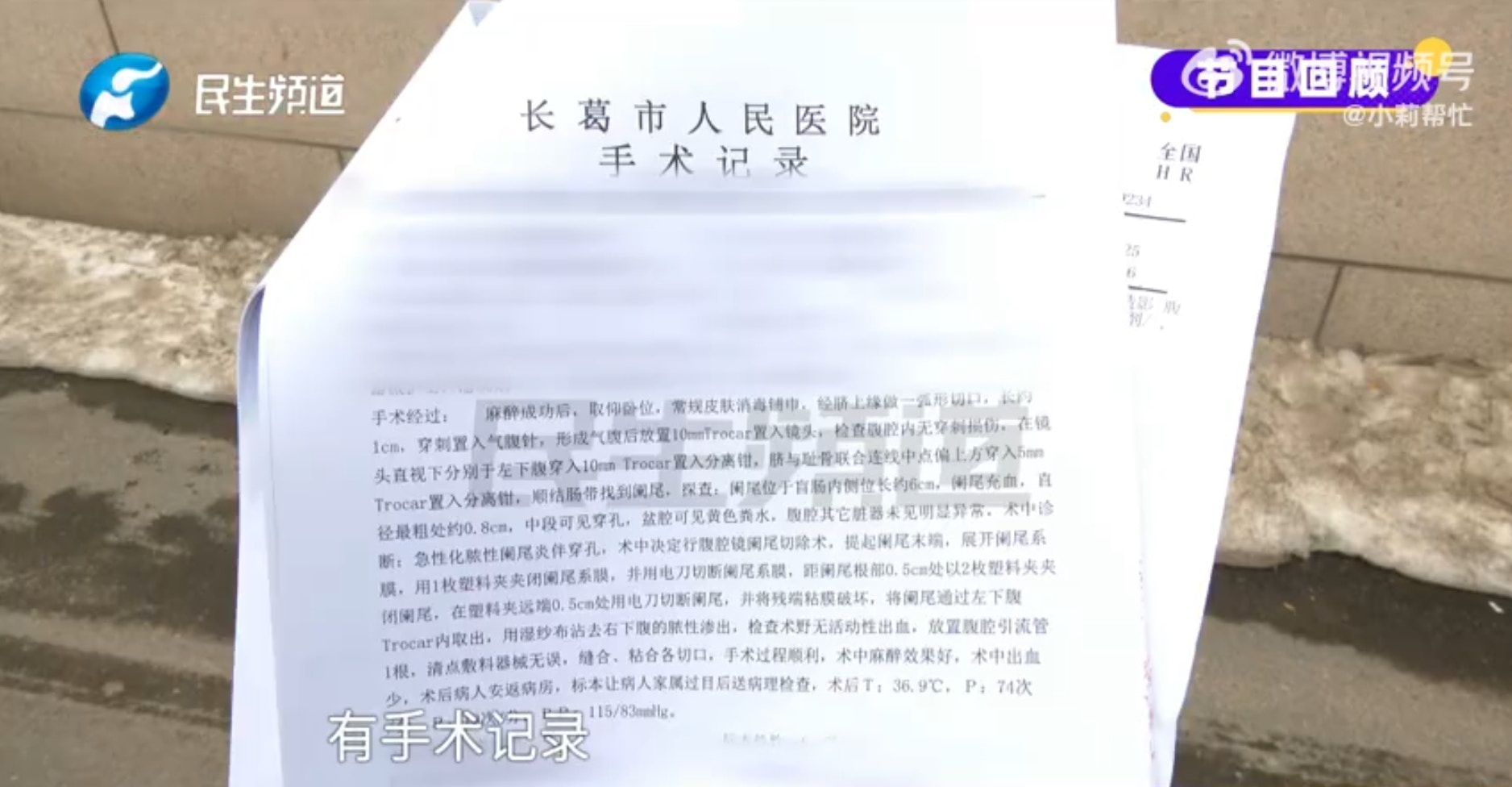 河南一名12歲男童在5年前因急性闌尾炎（俗稱盲腸炎）將闌尾切除，不料近日在進行檢查時竟發現「闌尾還在」，讓家屬頓時嚇傻：「那當時切了什麼？」對此，當地醫調委已介入調查。（微博＠小莉幫忙 ）