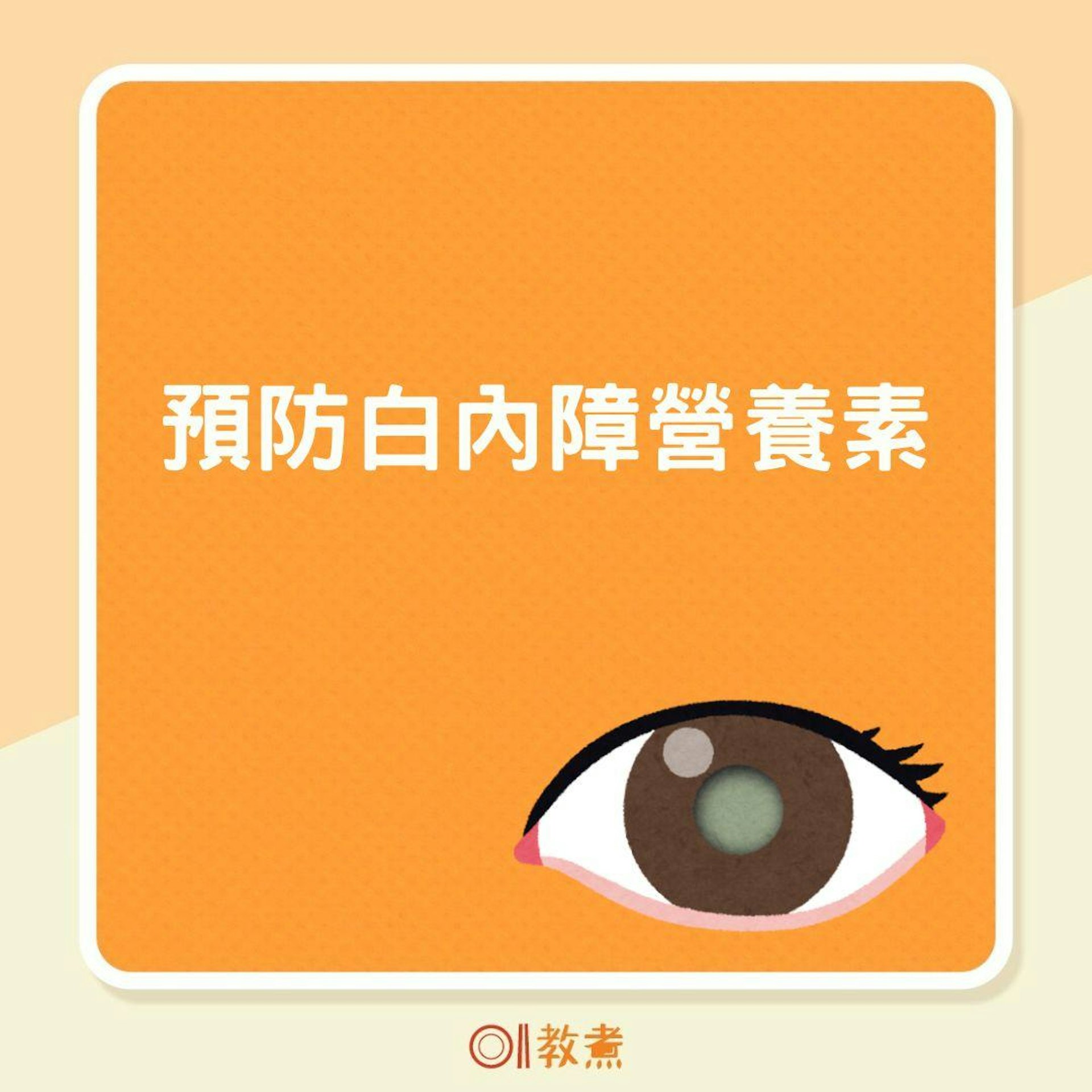 預防白內障營養素(01製圖) 預防白內障營養素(01製圖)
