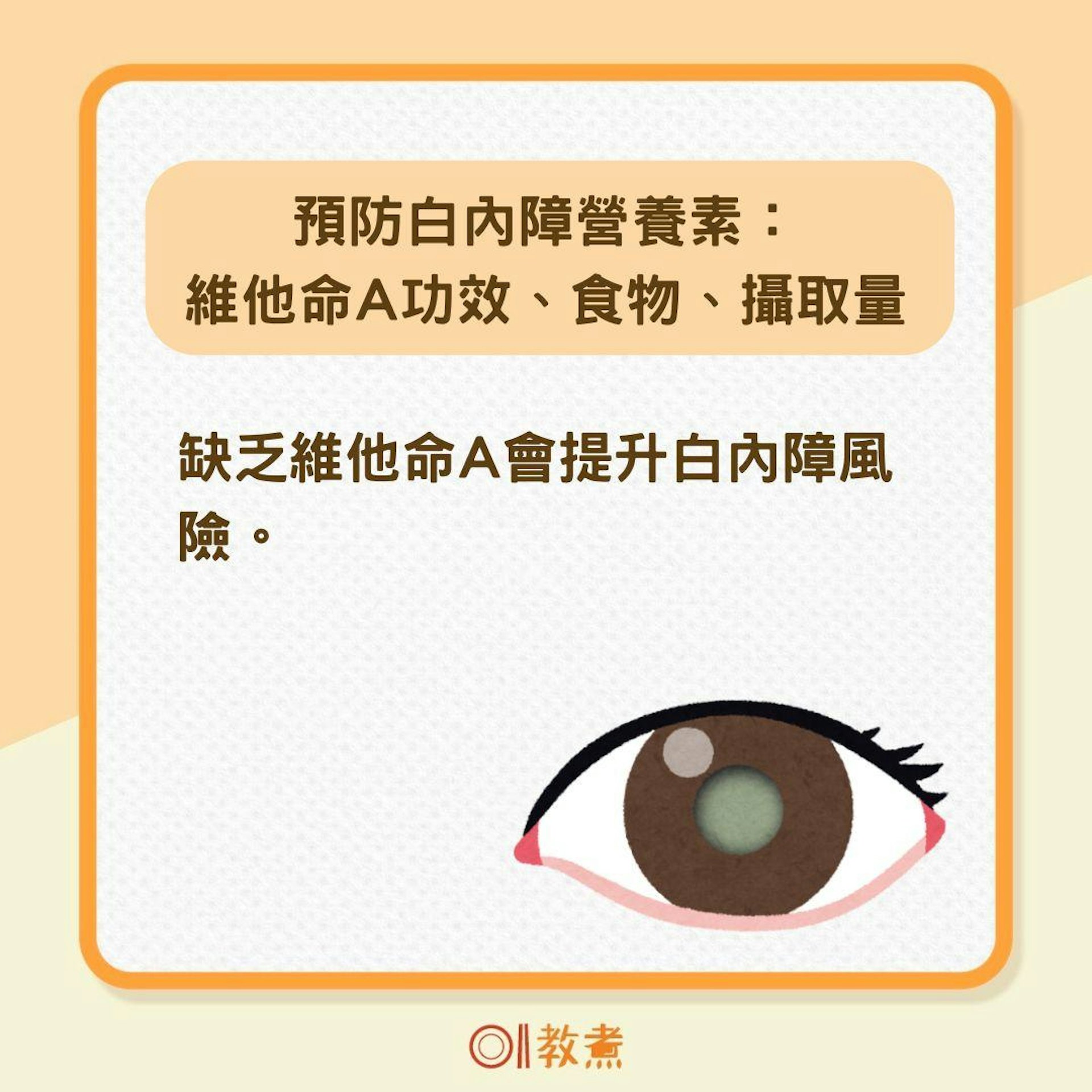 預防白內障營養素(01製圖) 預防白內障營養素(01製圖)