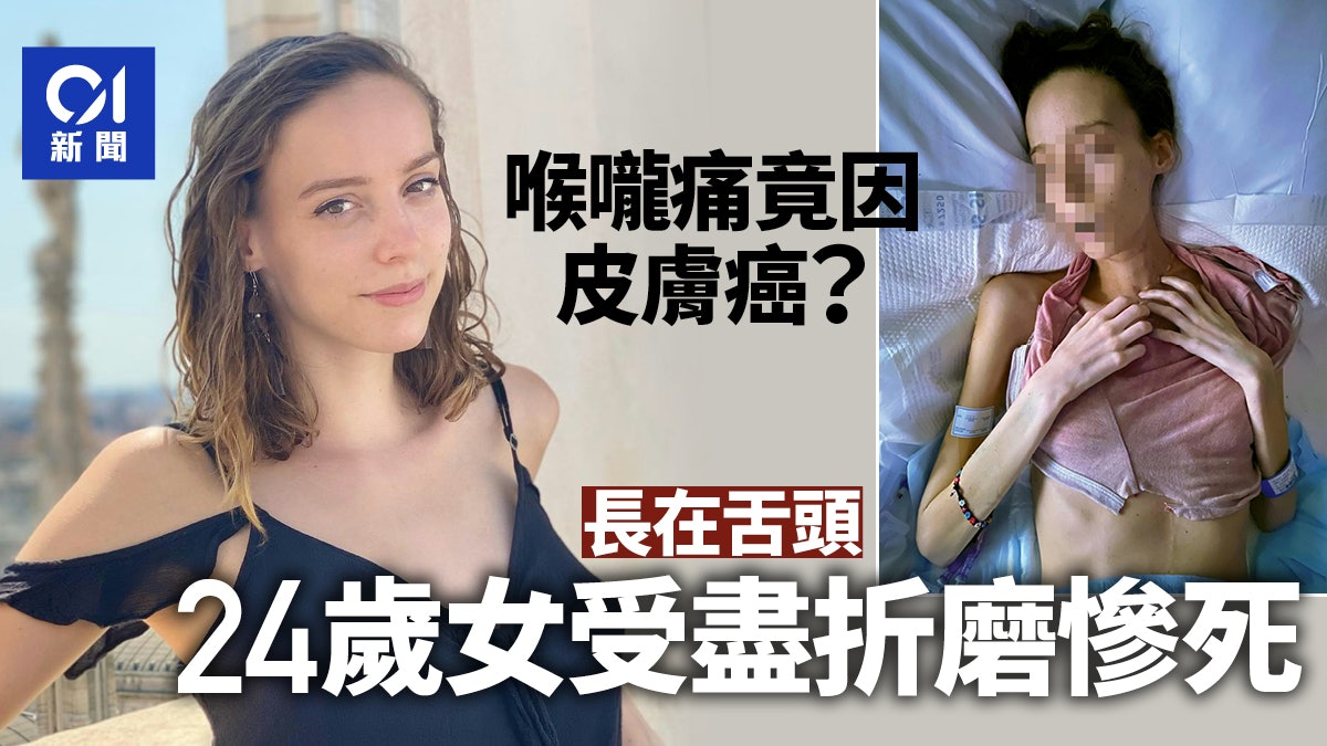 24歲女喉嚨痛竟是皮膚癌 原非致命癌症卻因長在舌頭受盡折磨離世 24歲女喉嚨痛竟是皮膚癌 原非致命癌症卻因長在舌頭受盡折磨離世