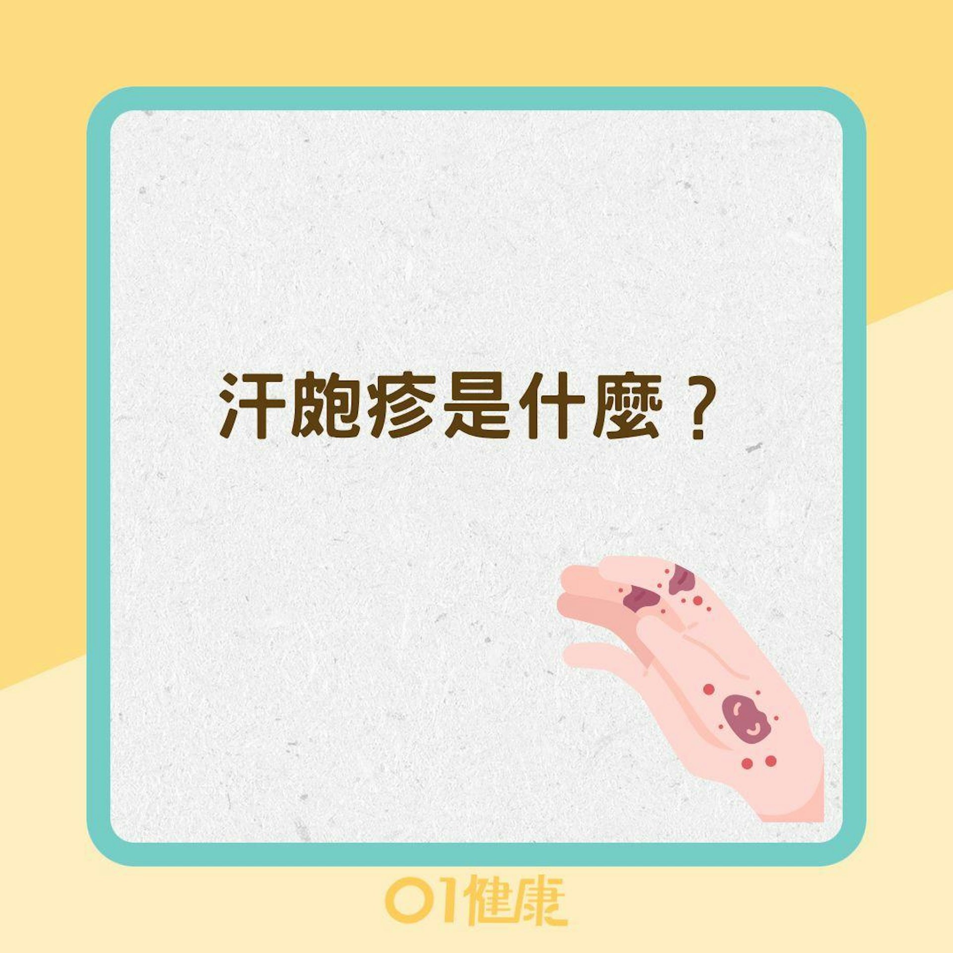 汗皰疹是什麼？（01製圖）