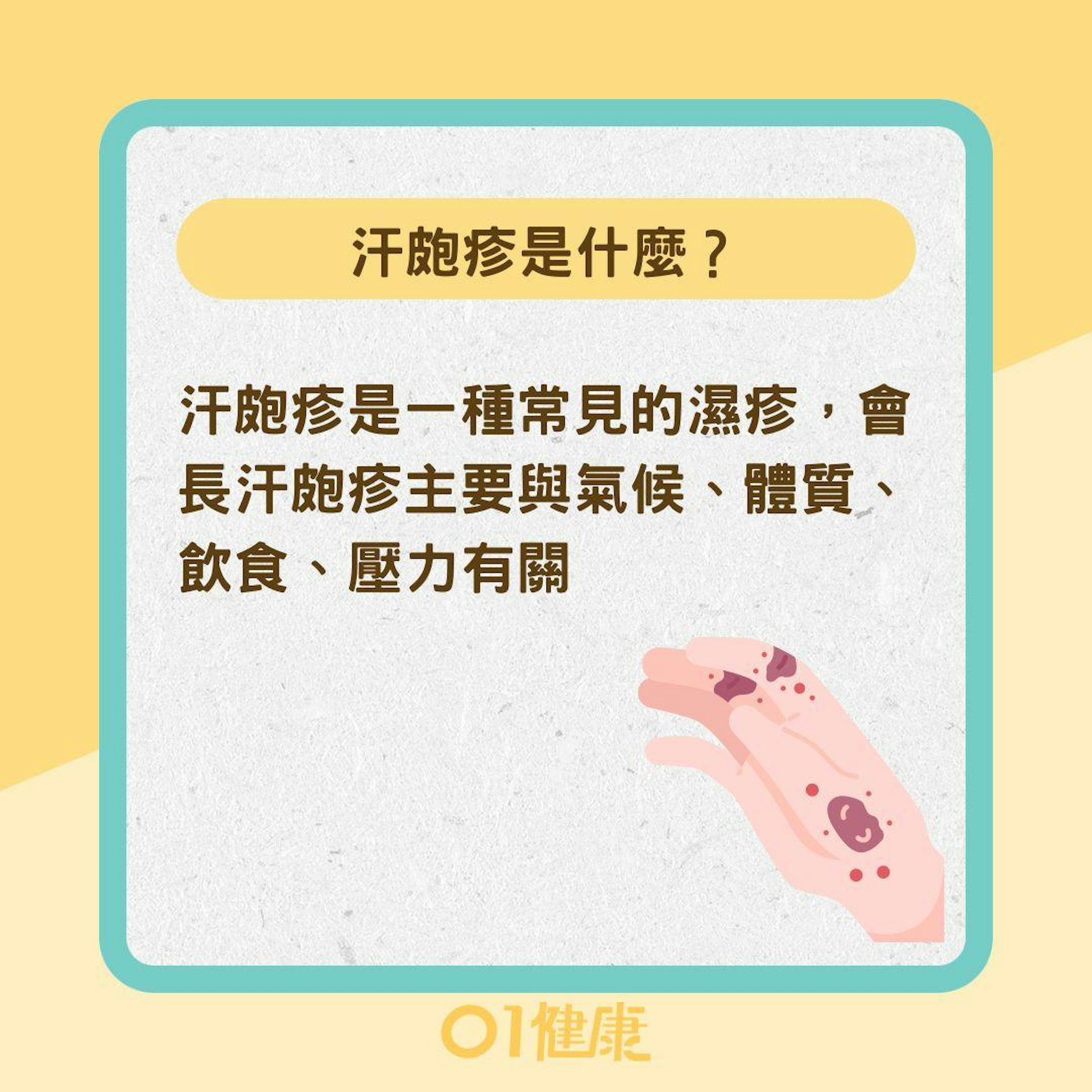 汗皰疹是什麼?(01製圖) 汗皰疹是什麼?(01製圖)