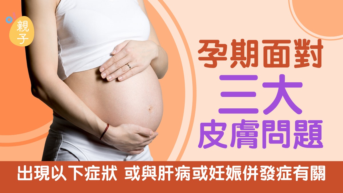 孕期3大皮膚問題紅疹、暗瘡、妊娠紋 某種情況可能患妊娠併發症 孕期3大皮膚問題紅疹、暗瘡、妊娠紋 某種情況可能患妊娠併發症