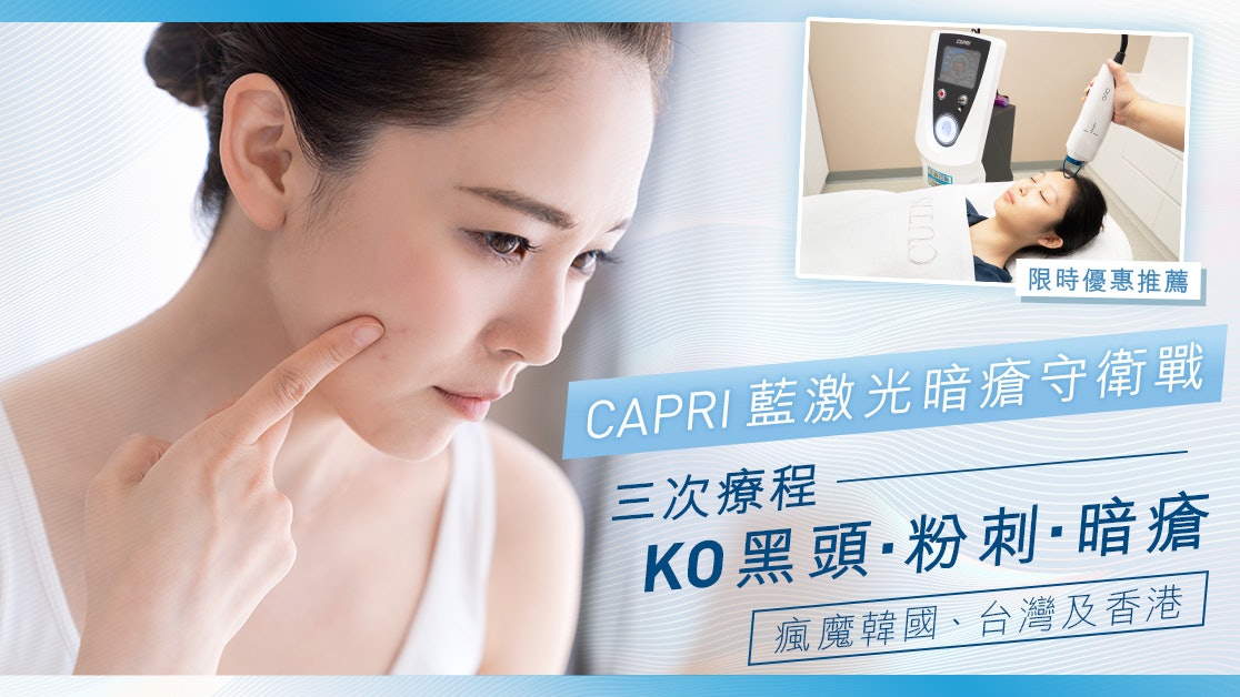 【CAPRI 藍激光暗瘡守衛戰】三次暗瘡療程KO黑頭.粉刺.暗瘡 【CAPRI 藍激光暗瘡守衛戰】三次暗瘡療程KO黑頭.粉刺.暗瘡