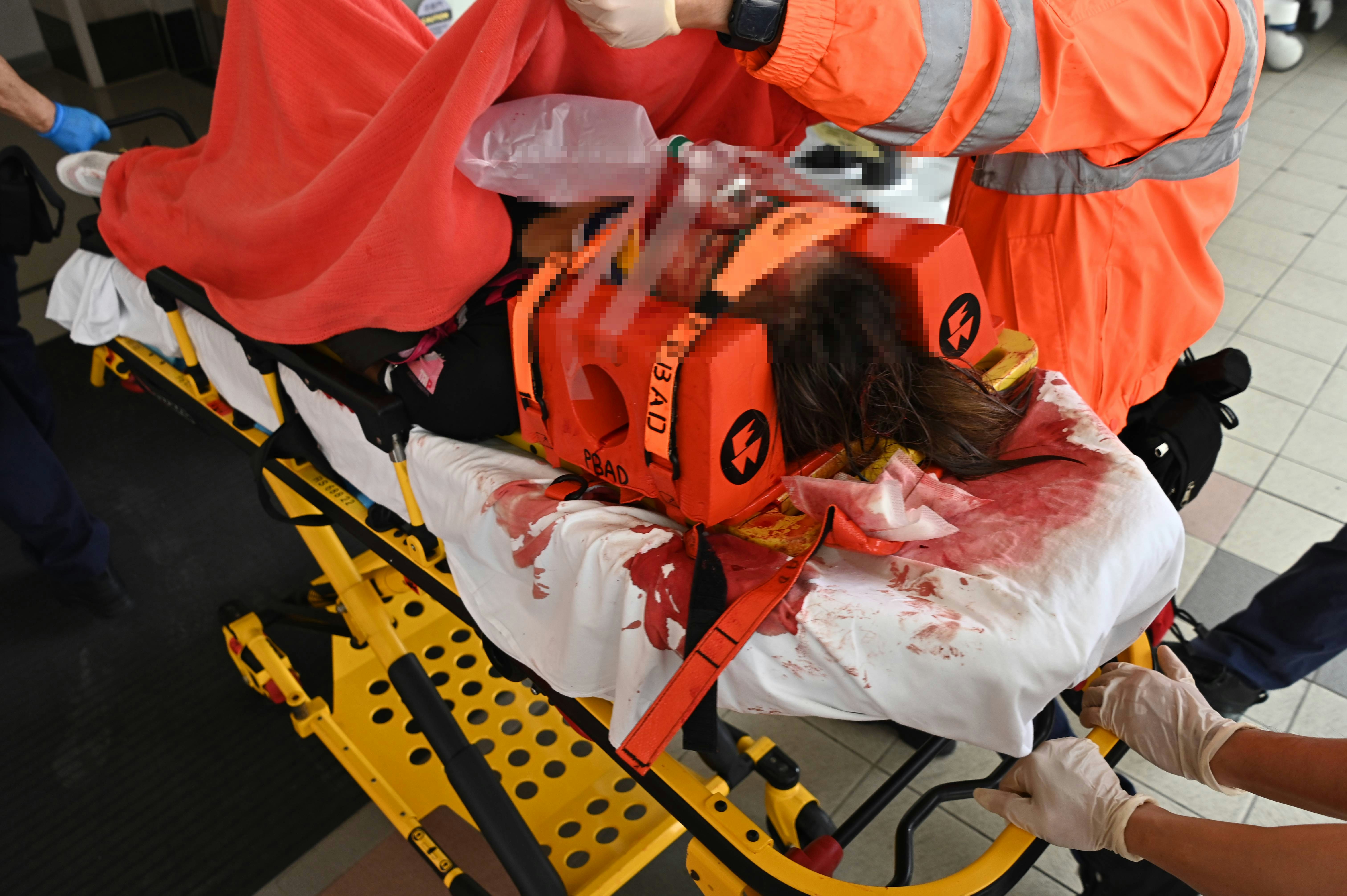 女伤者头部受伤，担架床染满鲜血，送往玛嘉烈医院抢救。