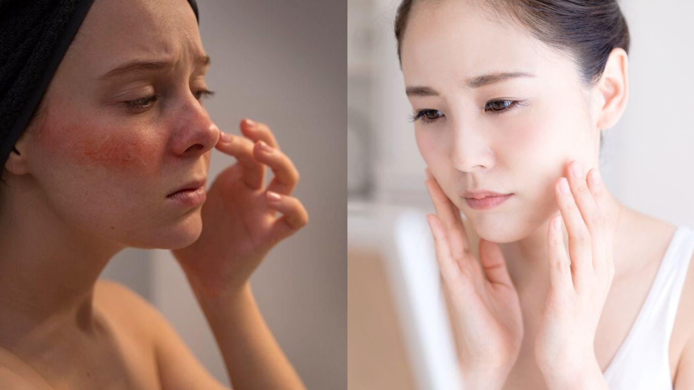 回南天、綿雨令皮膚容易敏感?中醫教你4招抗濕保養 擺脫濕重疲倦 回南天、綿雨令皮膚容易敏感?中醫教你4招抗濕保養 擺脫濕重疲倦