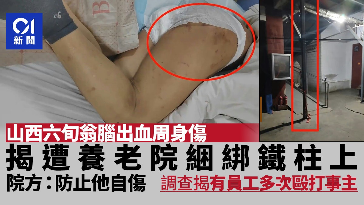 山西六旬翁遭養老院綁鐵柱滿身傷 女兒斥:我爸是去養老不是受罪 山西六旬翁遭養老院綁鐵柱滿身傷 女兒斥:我爸是去養老不是受罪