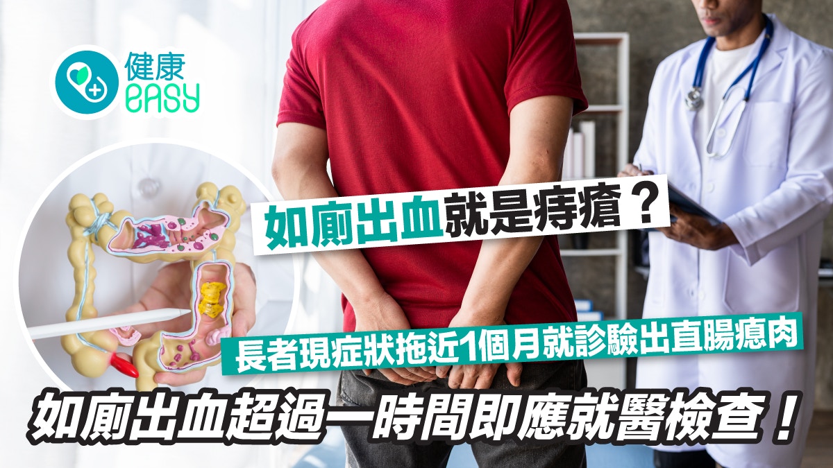 大腸癌｜如廁出血是痔瘡？長者現症狀拖近1個月就診驗出直腸瘜肉