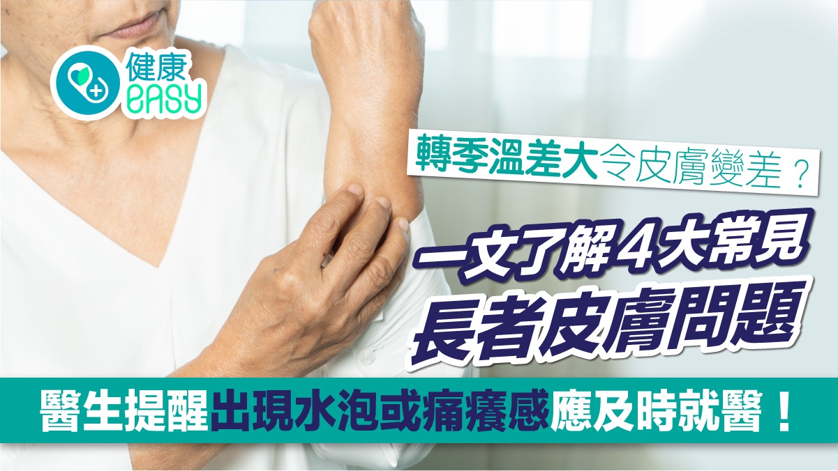 護膚｜季節轉換氣溫差異大使皮膚變差？現水泡或痛癢感應及時就醫