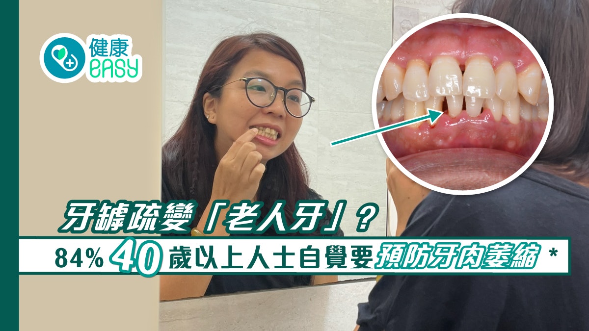 84% 40歲以上人士自覺要預防牙肉萎縮* 牙罅疏變「老人牙」? 84% 40歲以上人士自覺要預防牙肉萎縮* 牙罅疏變「老人牙」?