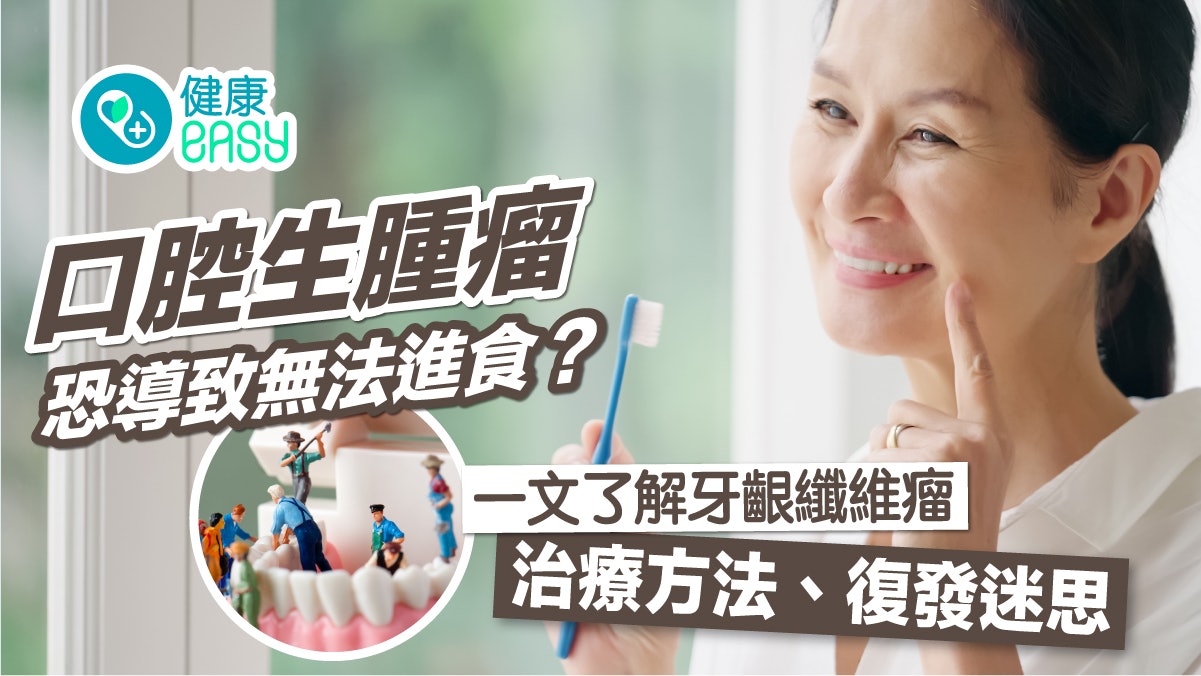 牙齦纖維瘤|腫瘤覆蓋牙齒無法進食?一文了解治療方法、復發迷思 牙齦纖維瘤|腫瘤覆蓋牙齒無法進食?一文了解治療方法、復發迷思