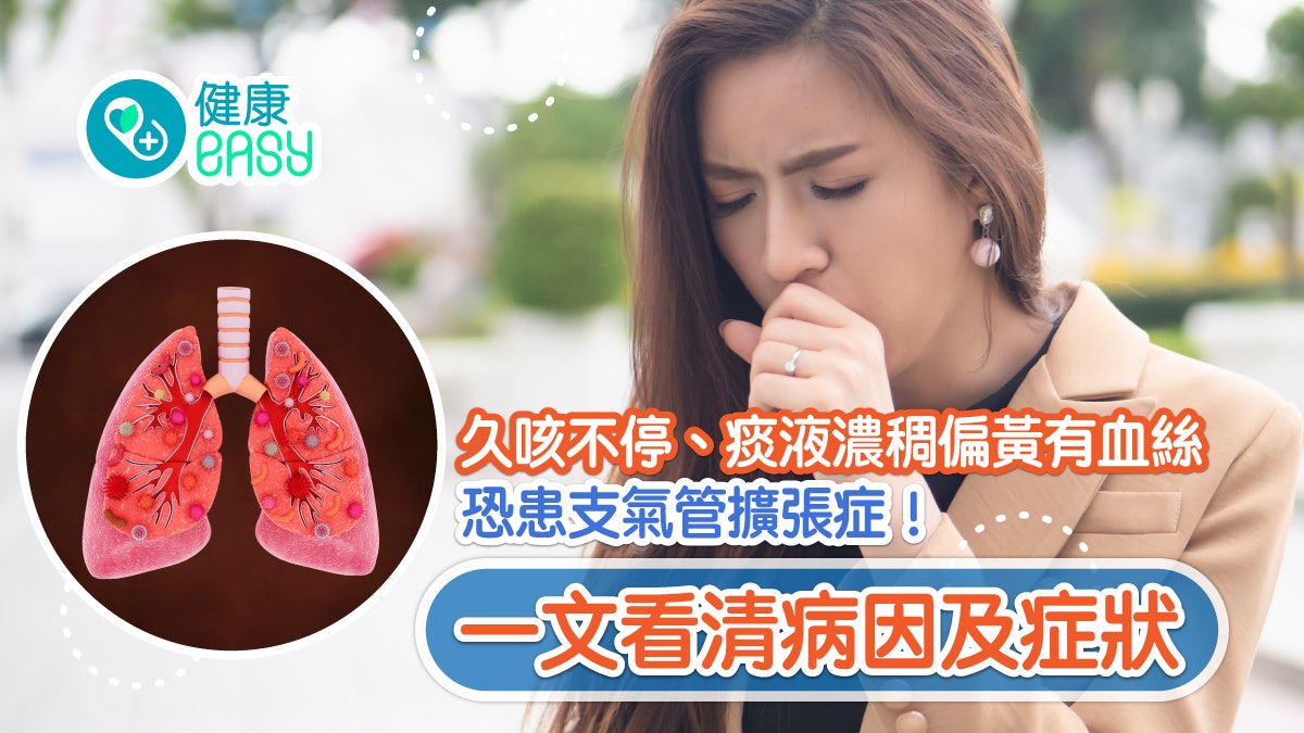 咳嗽|久咳不停痰液濃稠偏黃有血絲!一文看清支氣管擴張症症狀 咳嗽|久咳不停痰液濃稠偏黃有血絲!一文看清支氣管擴張症症狀