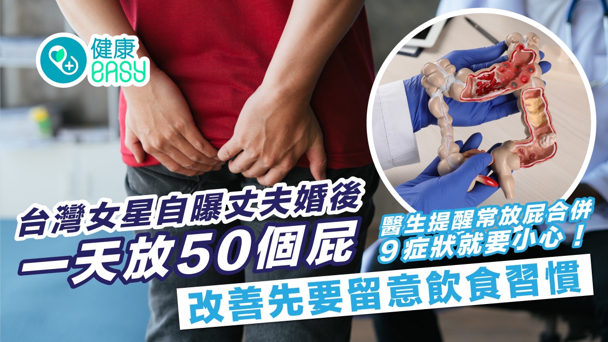 胃腸健康|一天放50個屁正常嗎?醫生提醒常放屁合併9症狀要小心 胃腸健康|一天放50個屁正常嗎?醫生提醒常放屁合併9症狀要小心