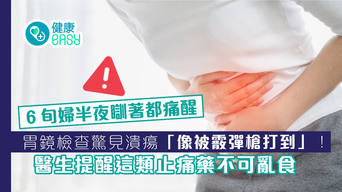 胃潰瘍|6旬婦半夜胃痛醒 胃鏡檢查驚見傷口「像被霰彈槍打到」! 胃潰瘍|6旬婦半夜胃痛醒 胃鏡檢查驚見傷口「像被霰彈槍打到」!