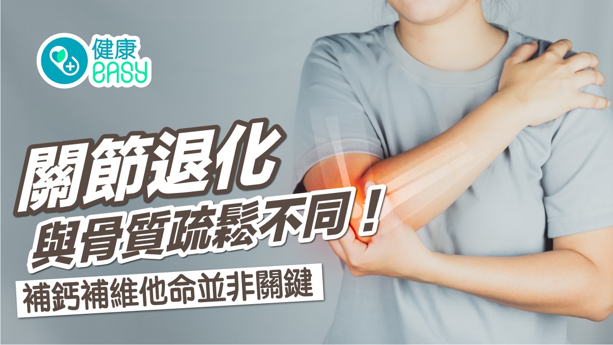 關節退化|與骨質疏鬆不同!漸進式惡化 補鈣補維他命並非關鍵 關節退化|與骨質疏鬆不同!漸進式惡化 補鈣補維他命並非關鍵