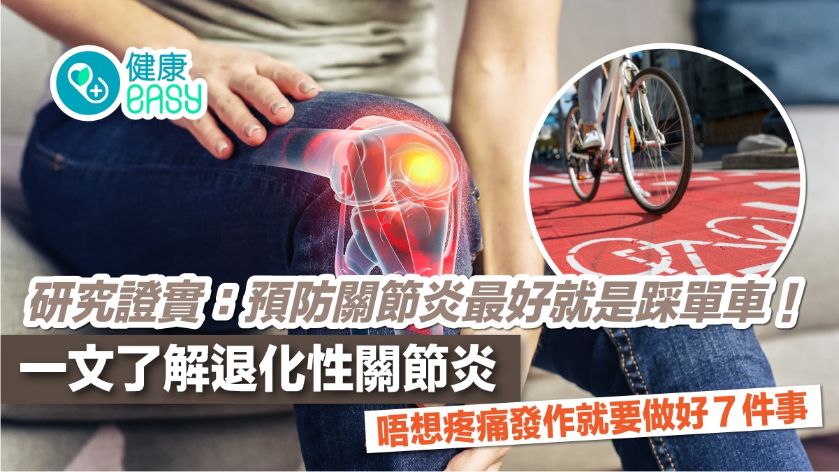 預防關節炎的最佳運動是踩單車!預防疼痛復發要留意7件事! 預防關節炎的最佳運動是踩單車!預防疼痛復發要留意7件事!