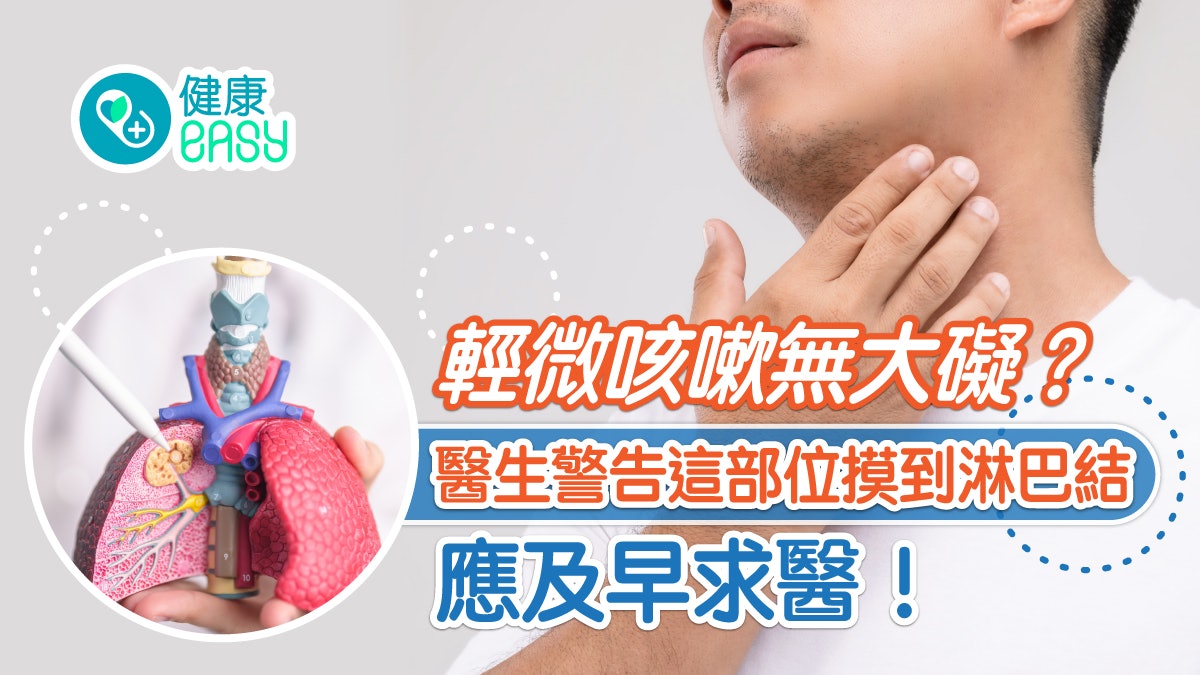 肺癌|症狀輕微肺部卻有5厘米腫瘤!這部位摸到淋巴結應及早求醫 肺癌|症狀輕微肺部卻有5厘米腫瘤!這部位摸到淋巴結應及早求醫