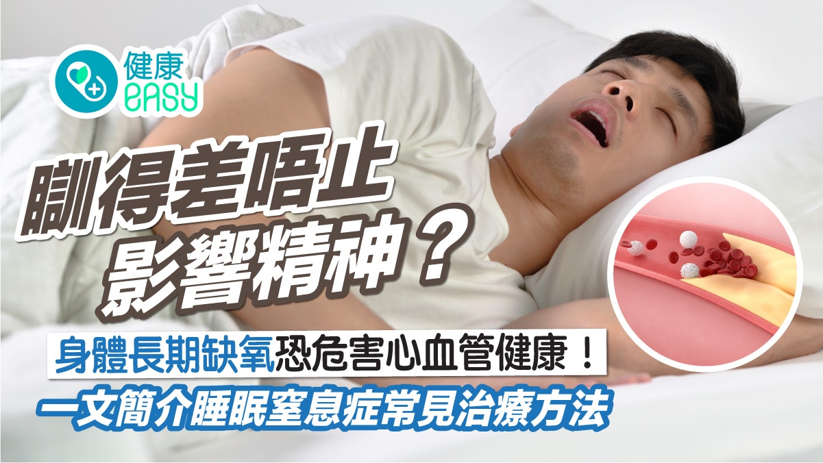鼻鼾|身體缺氧危害心血管健康?盤點睡眠窒息症4種常見治療方式 鼻鼾|身體缺氧危害心血管健康?盤點睡眠窒息症4種常見治療方式