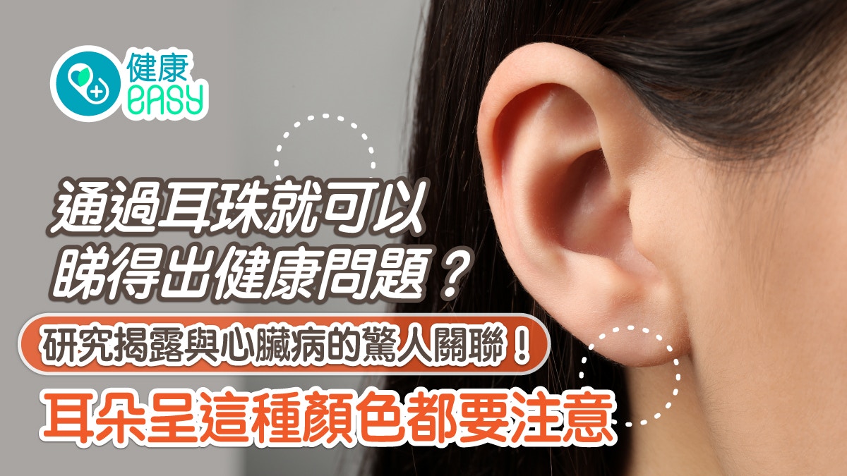 耳珠｜耳垂特徵反映心血管健康狀況？耳朵顏色異常或與4疾病相關