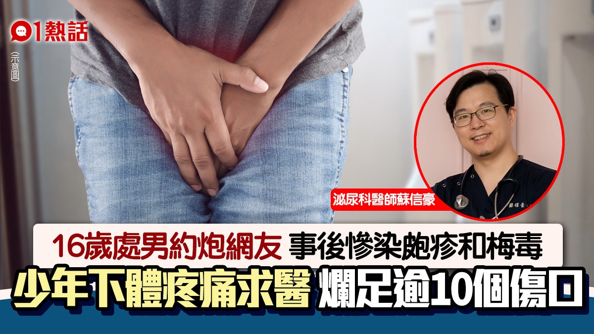 16歲仔下體潰爛現10幾個洞!驚患皰疹+梅毒 父親前自爆染病原因 16歲仔下體潰爛現10幾個洞!驚患皰疹+梅毒 父親前自爆染病原因
