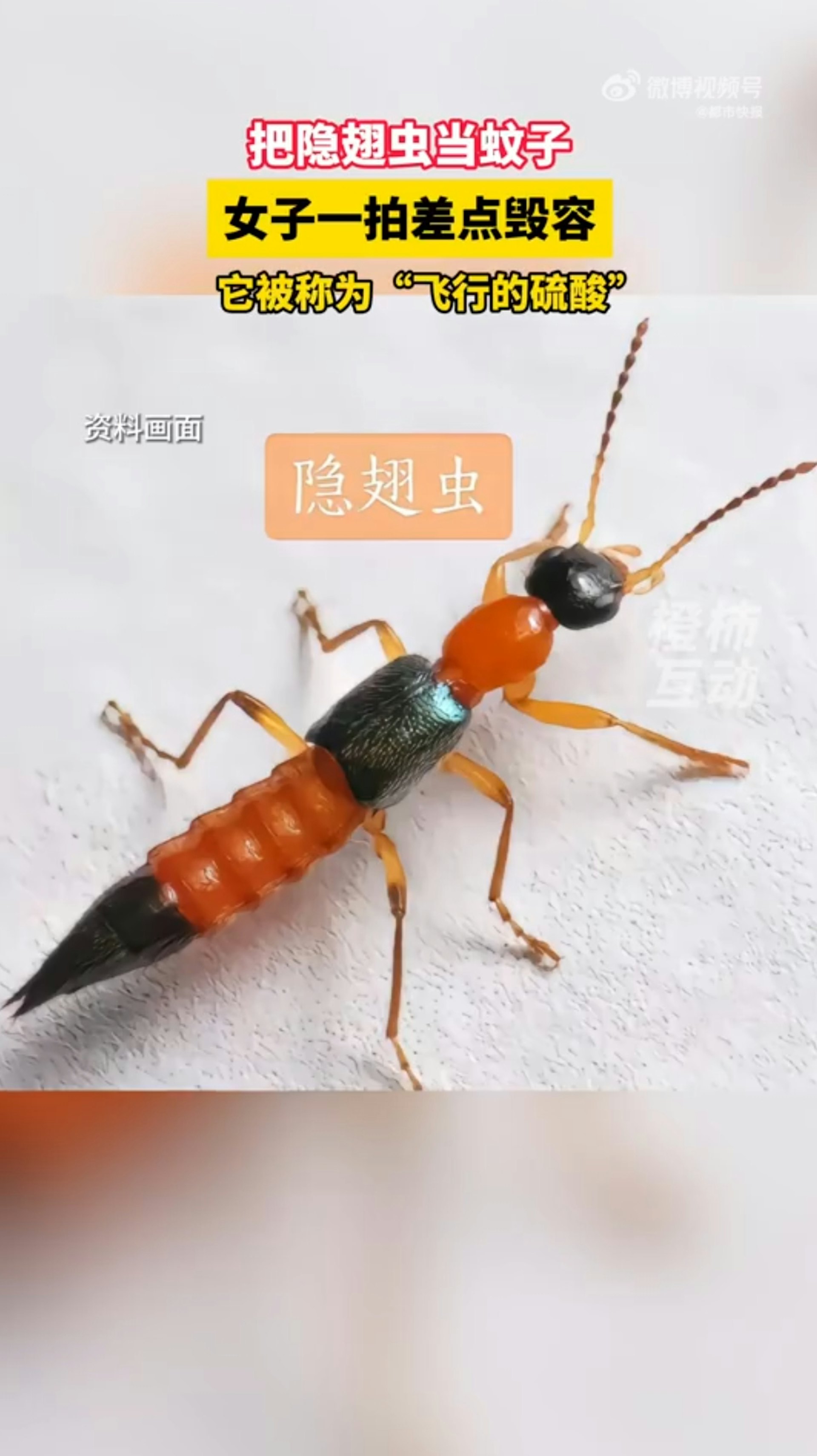 浙江省紹興市一名王姓女子日前在家中睡覺,突然感覺臉上有蟲子,於是隨手將蟲子打死。豈料隔天起床時,發現臉部出現紅斑、水泡,差點因此毀容,就醫之後才知道打死的不是蚊子,而是隱翅蟲。(微博@都市快報) 浙江省紹興市一名王姓女子日前在家中睡覺,突然感覺臉上有蟲子,於是隨手將蟲子打死。豈料隔天起床時,發現臉部出現紅斑、水泡,差點因此毀容,就醫之後才知道打死的不是蚊子,而是隱翅蟲。(微博@都市快報)