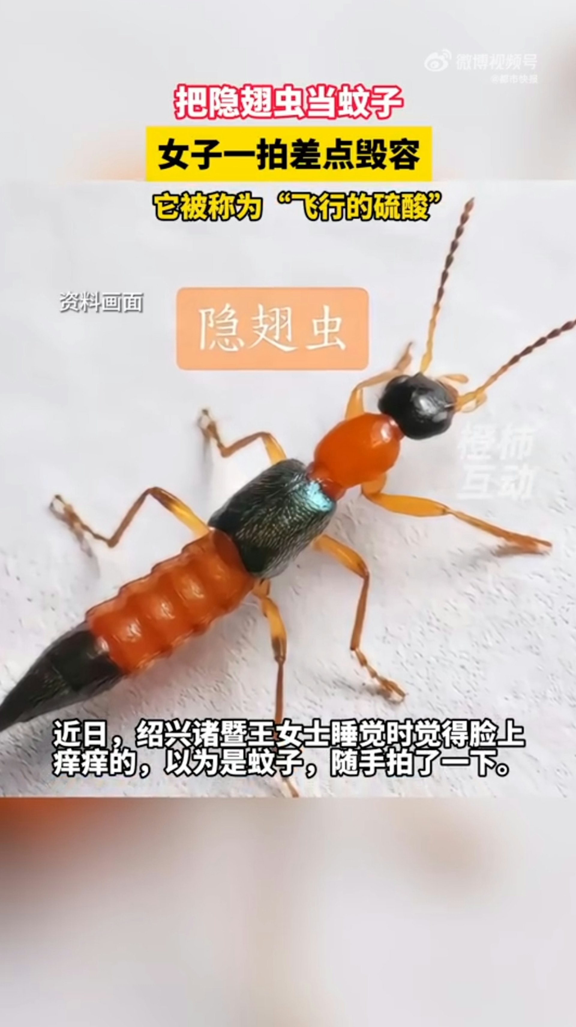 浙江省紹興市一名王姓女子日前在家中睡覺,突然感覺臉上有蟲子,於是隨手將蟲子打死。豈料隔天起床時,發現臉部出現紅斑、水泡,差點因此毀容,就醫之後才知道打死的不是蚊子,而是隱翅蟲。(微博@都市快報) 浙江省紹興市一名王姓女子日前在家中睡覺,突然感覺臉上有蟲子,於是隨手將蟲子打死。豈料隔天起床時,發現臉部出現紅斑、水泡,差點因此毀容,就醫之後才知道打死的不是蚊子,而是隱翅蟲。(微博@都市快報)