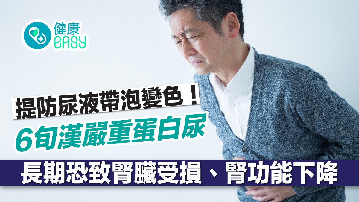 腎病|提防尿液帶泡變色!6旬漢嚴重蛋白尿 一天流失28克蛋白質 腎病|提防尿液帶泡變色!6旬漢嚴重蛋白尿 一天流失28克蛋白質