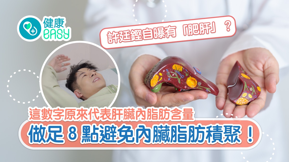 脂肪肝｜許廷鏗自曝有「肥肝」？ 這８點避免內臟脂肪積聚