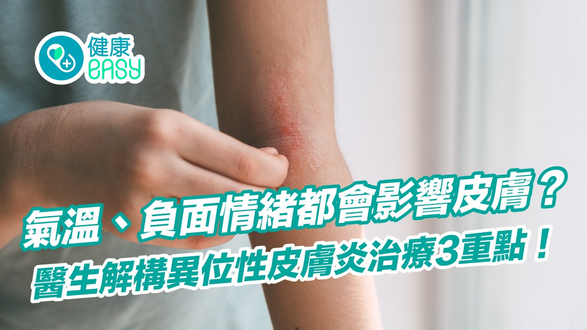 濕疹|氣溫、負面情緒影響皮膚?醫生解構異位性皮膚炎治療3重點 濕疹|氣溫、負面情緒影響皮膚?醫生解構異位性皮膚炎治療3重點