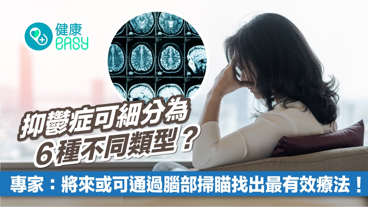 醫療新知|專家將抑鬱症細分為6類 腦部掃描加快找出有效療法! 醫療新知|專家將抑鬱症細分為6類 腦部掃描加快找出有效療法!
