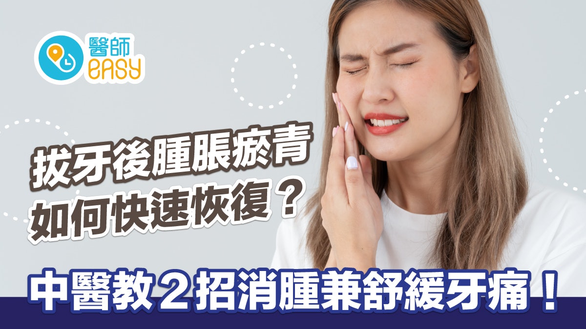 剝牙|拔牙後腫脹瘀青如何快速恢復?按壓2穴位1茶飲消腫紓緩牙痛 剝牙|拔牙後腫脹瘀青如何快速恢復?按壓2穴位1茶飲消腫紓緩牙痛