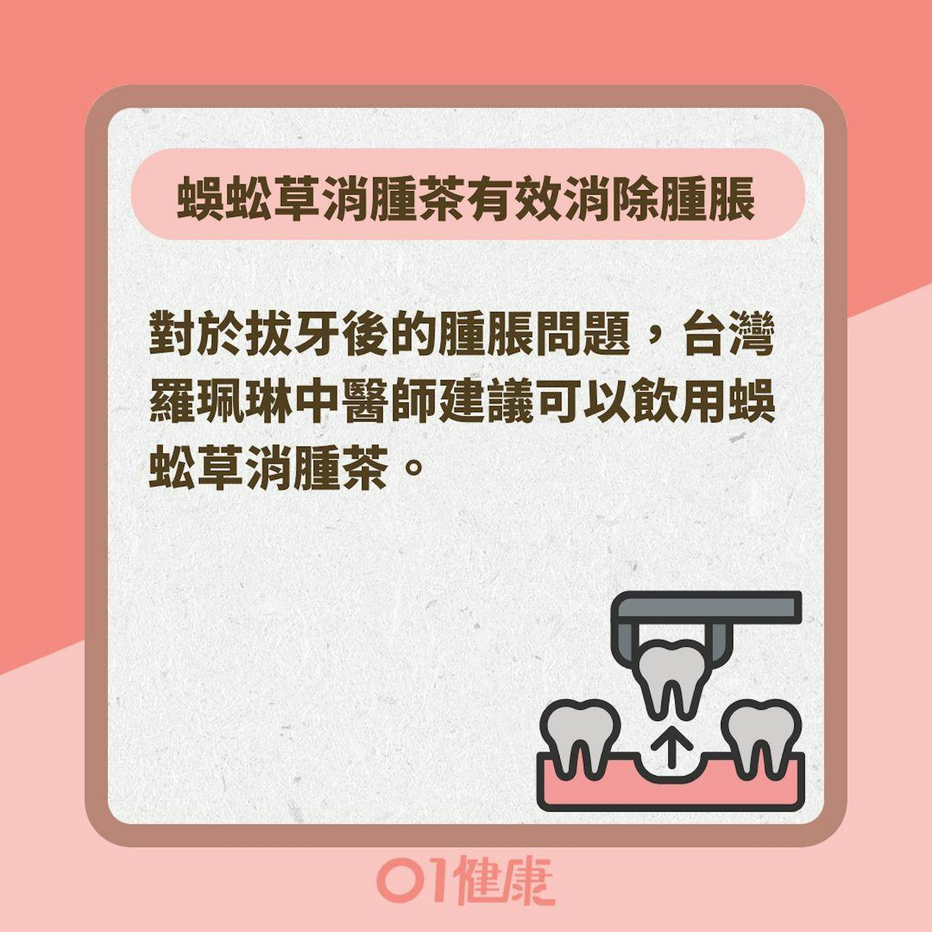 拔牙腫脹怎麼辦?(01製圖 ) 拔牙腫脹怎麼辦?(01製圖 )