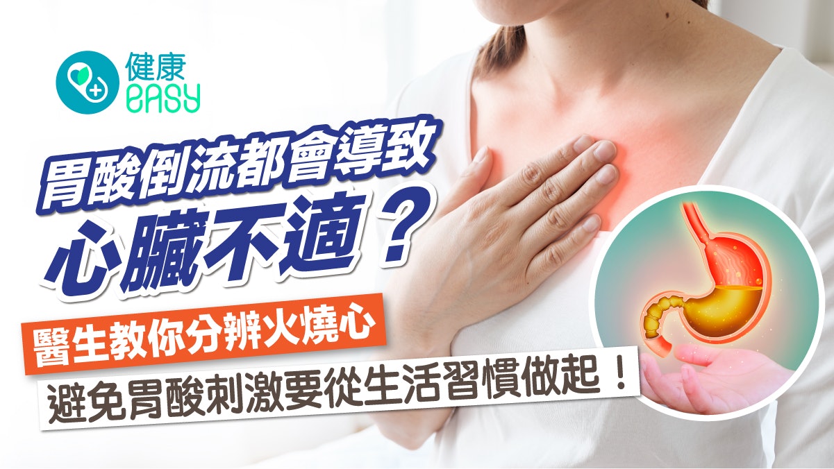 胃酸倒流都會導致心臟不適?先做1件事改善胃酸倒流避免刺激物質 胃酸倒流都會導致心臟不適?先做1件事改善胃酸倒流避免刺激物質