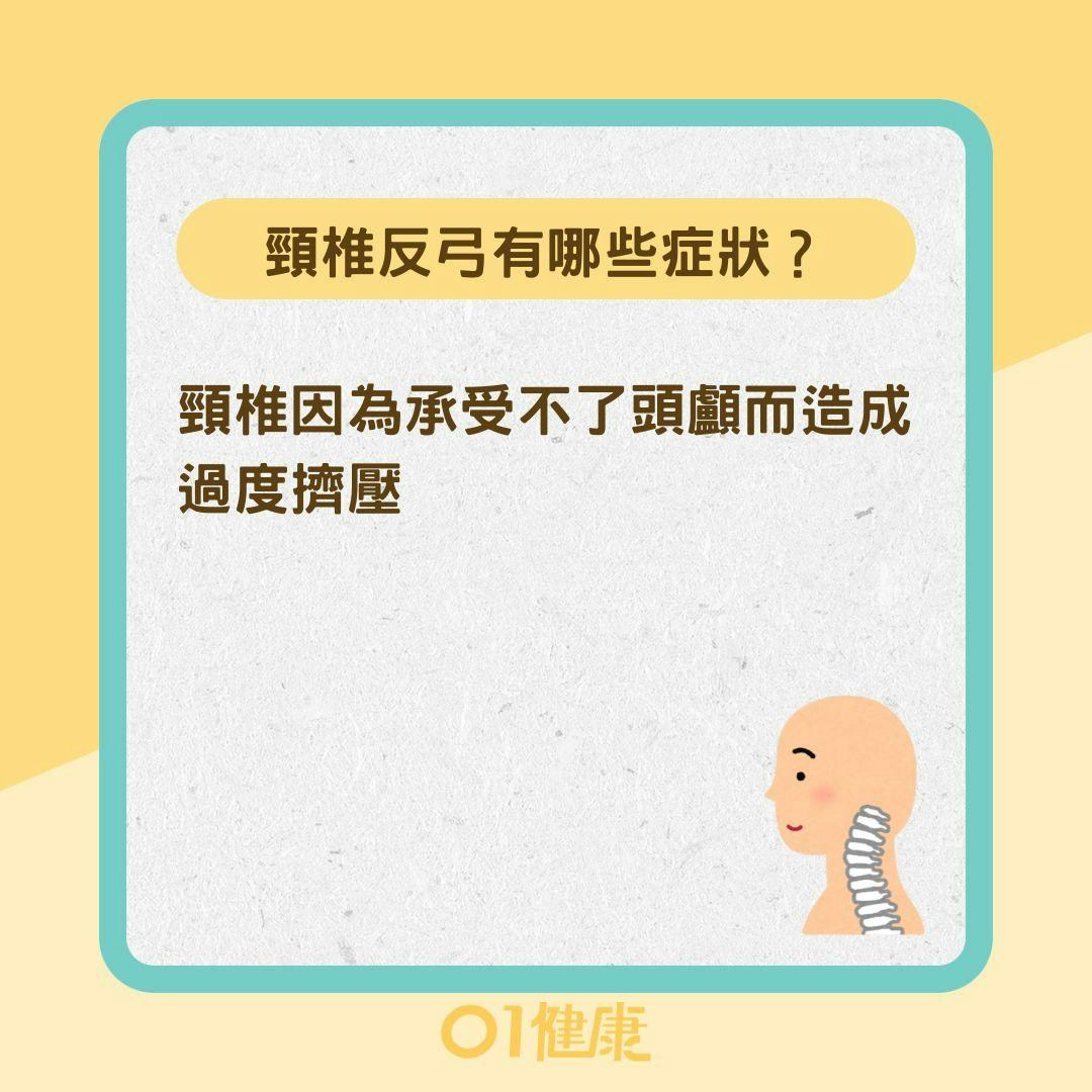 頸椎反弓有哪些症狀？頸椎反弓如何治療 （01製圖）