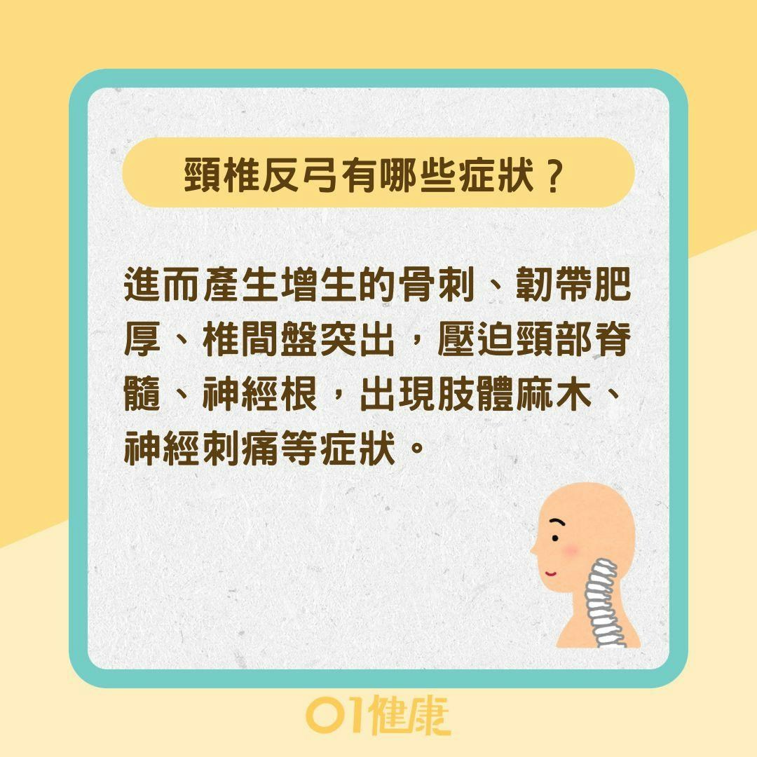 頸椎反弓有哪些症狀？頸椎反弓如何治療 （01製圖）