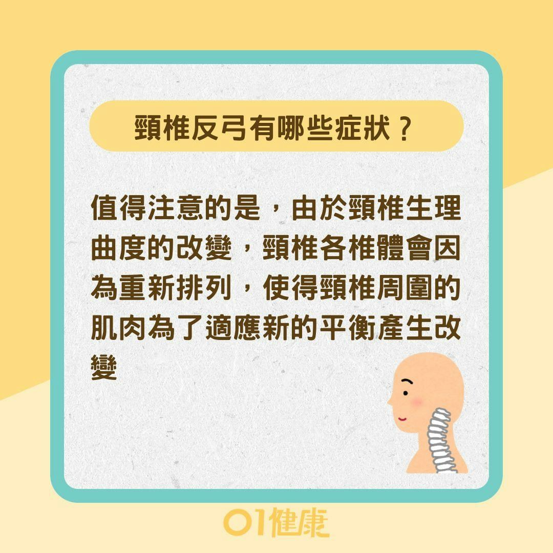 頸椎反弓有哪些症狀？頸椎反弓如何治療 （01製圖）