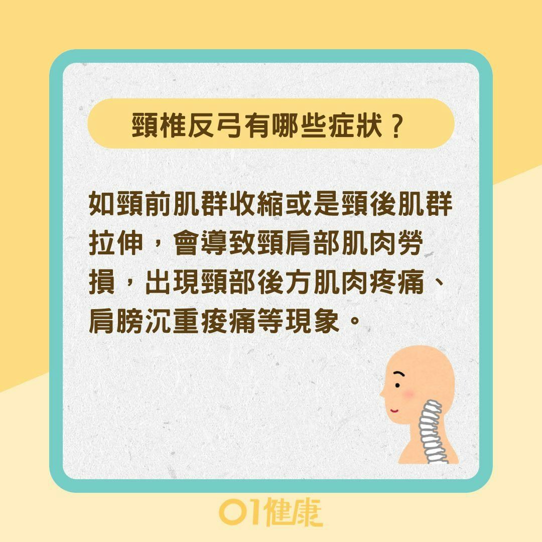 頸椎反弓有哪些症狀？頸椎反弓如何治療 （01製圖）