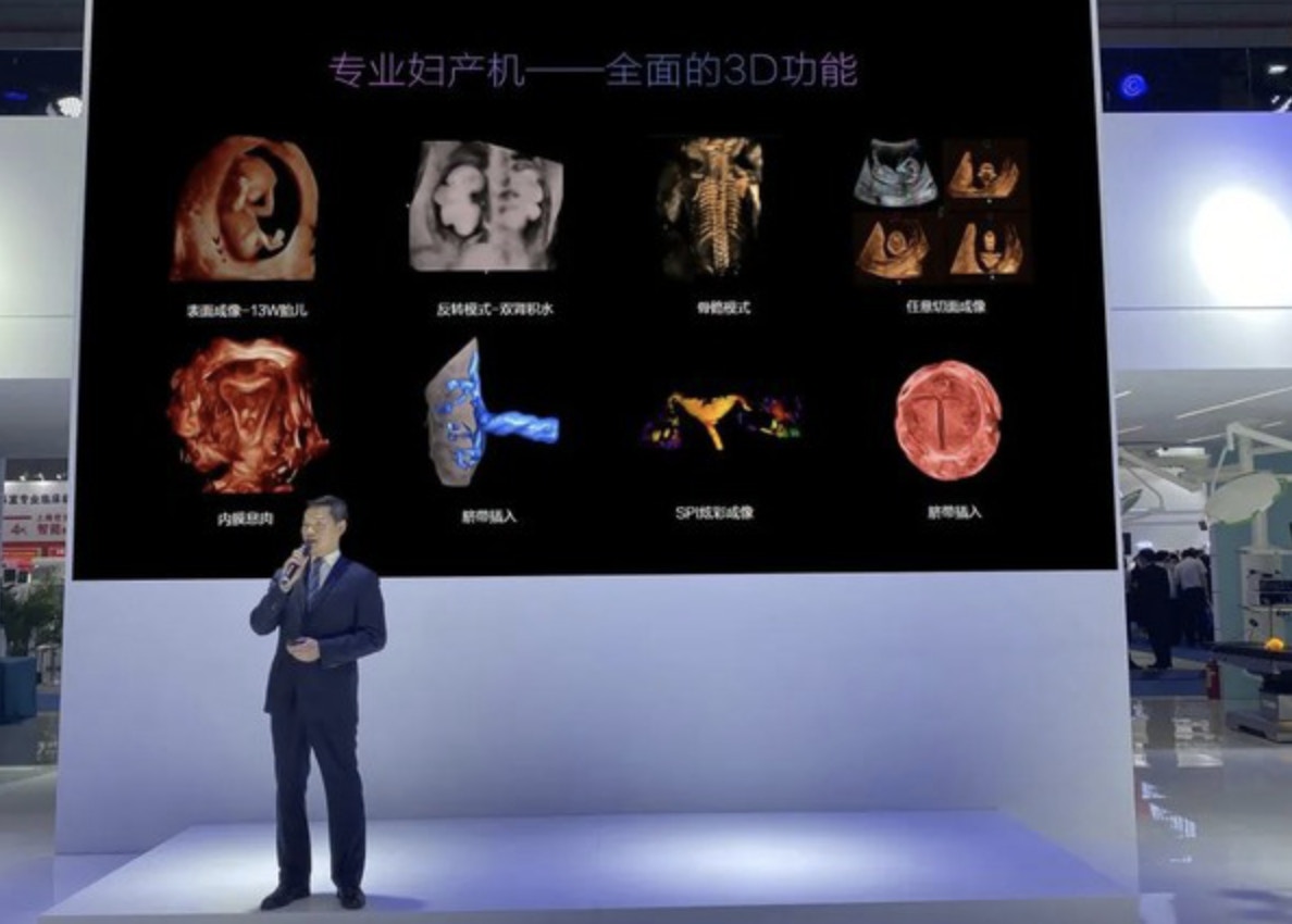 深圳開立生物醫療科技，公司市值高達178億元。（網絡圖片）