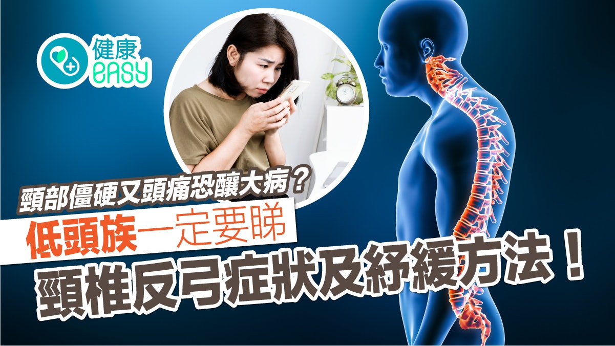 低頭族頸部僵硬痠痛又頭痛已患病?一文看清頸椎反弓症狀治療方法 低頭族頸部僵硬痠痛又頭痛已患病?一文看清頸椎反弓症狀治療方法