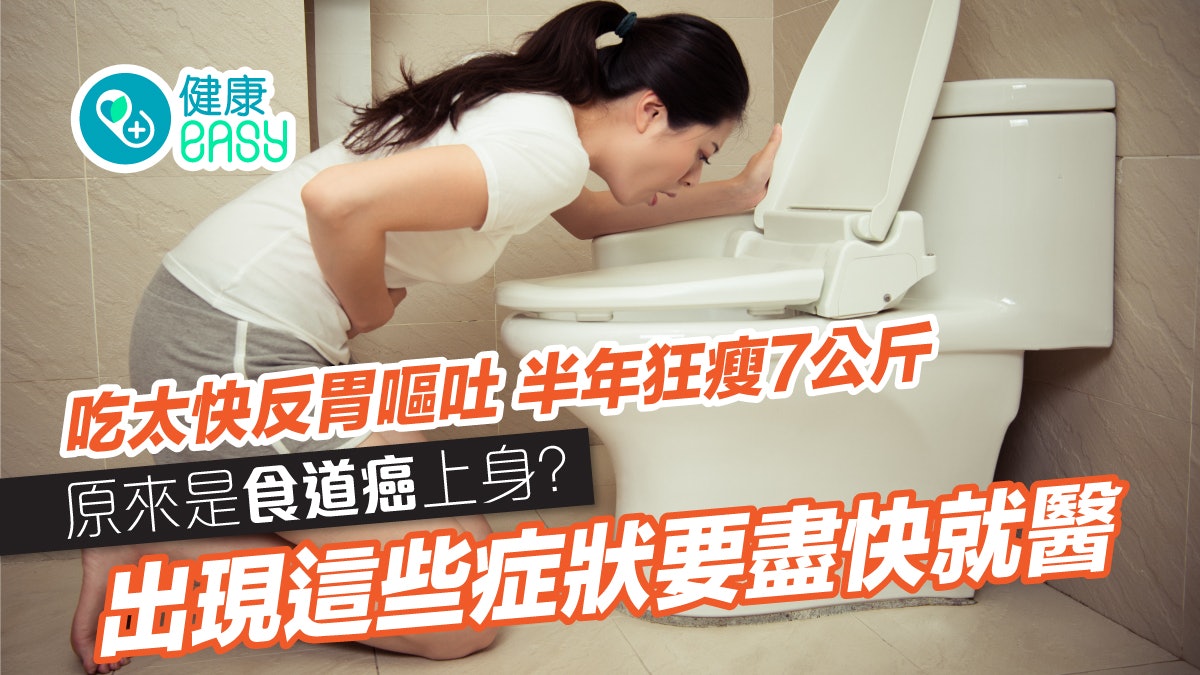 食道癌|吞嚥困難往往已是中晚期?長期接觸3物出現5症狀應就醫 食道癌|吞嚥困難往往已是中晚期?長期接觸3物出現5症狀應就醫