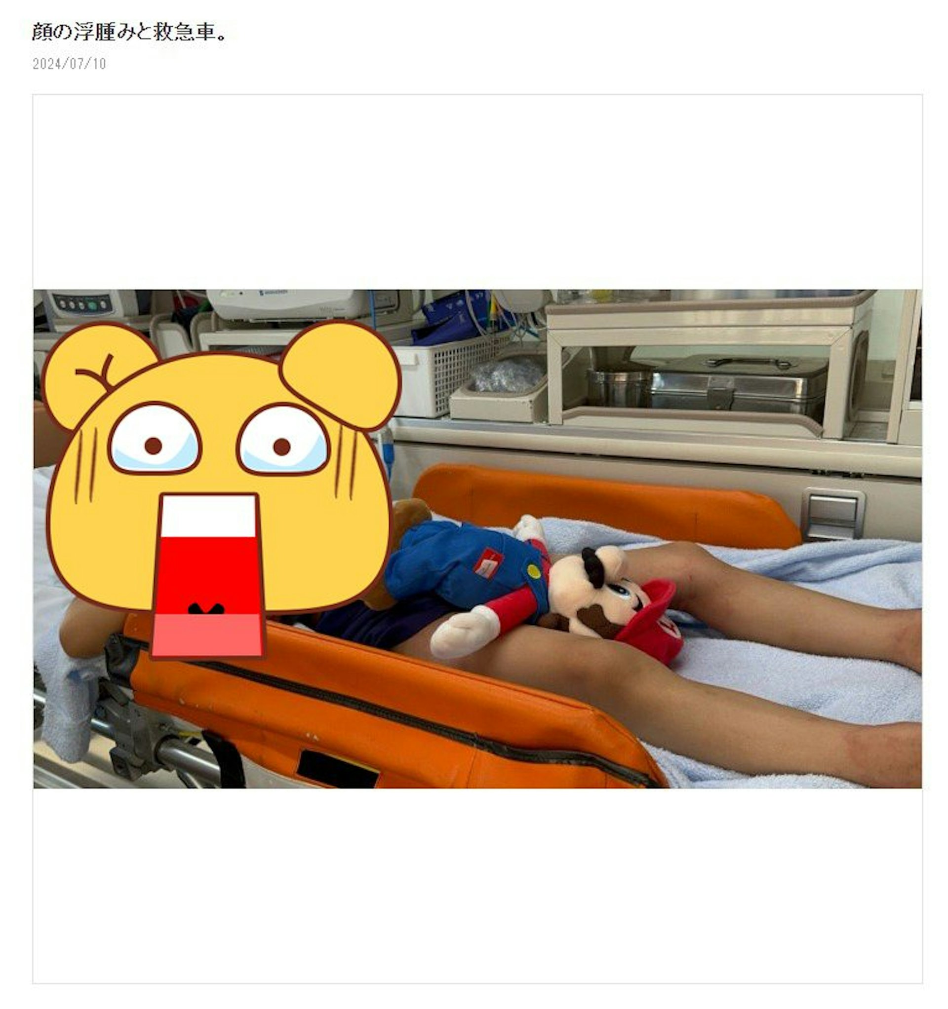 蒼井空分享兒子臉腫躺救護車的正片引起爭議。(ameblo) 蒼井空分享兒子臉腫躺救護車的正片引起爭議。(ameblo)