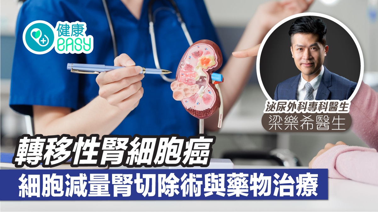 轉移性腎細胞癌 - 細胞減量腎切除術與藥物治療 轉移性腎細胞癌 - 細胞減量腎切除術與藥物治療