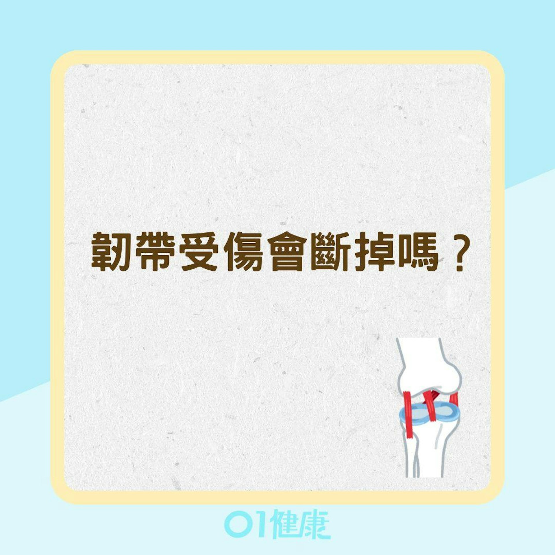 韌帶受傷會斷掉嗎?(01製圖) 韌帶受傷會斷掉嗎?(01製圖)