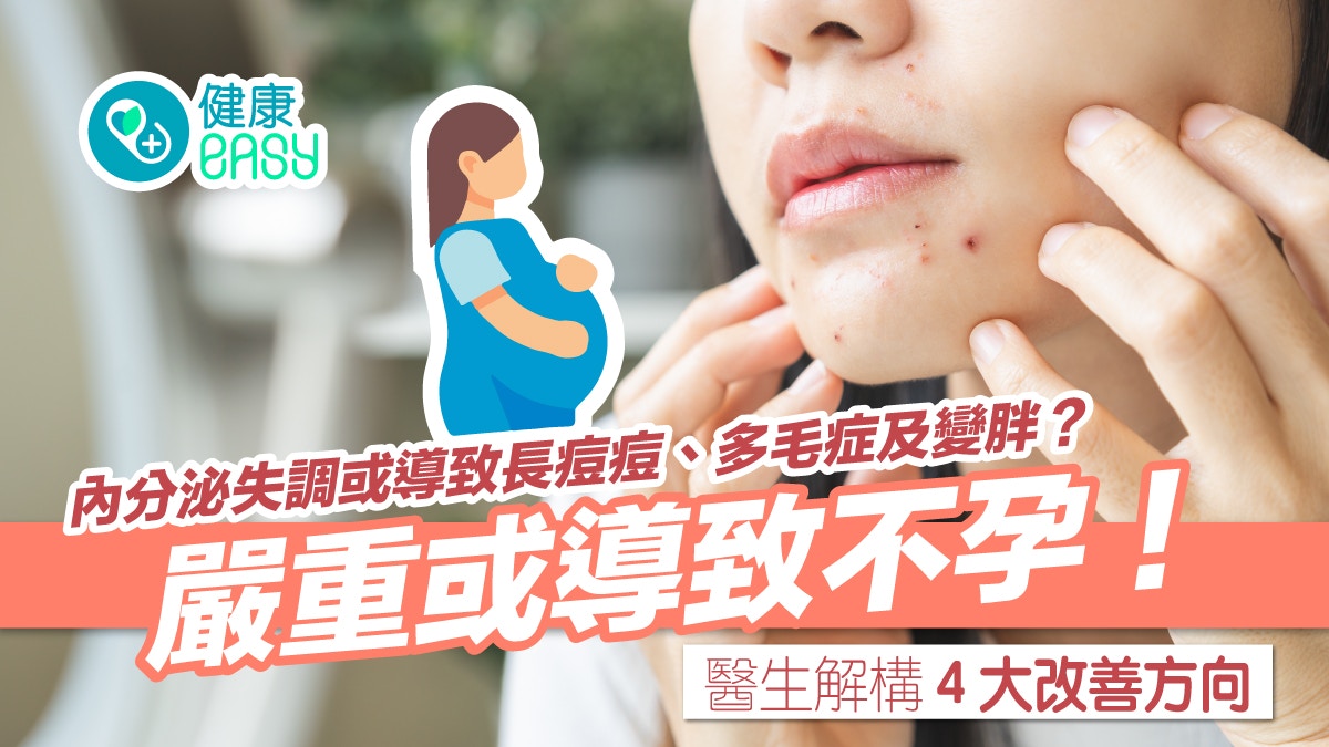 多囊性卵巢症｜臉部長期現痘瘡、紅疹？3症狀符合2項就可能患病